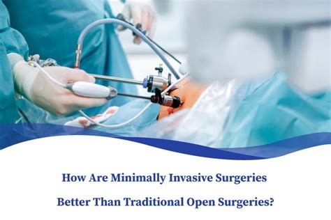 nq minimally invasive surgery.